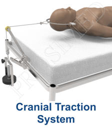 Cranial Traction System