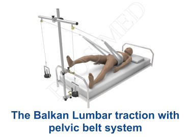 The Balkan Lumbar traction with pelvic belt system