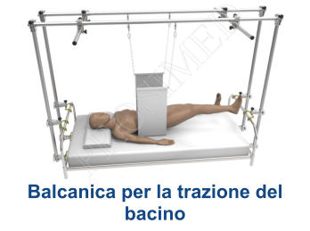 Balcanica per la trazione del bacino